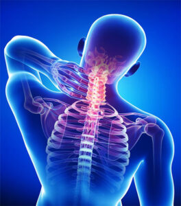 Cervical Pain