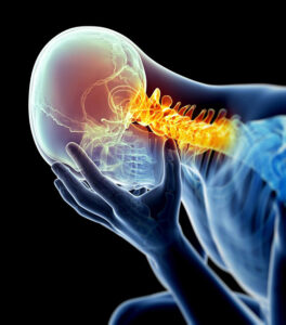 Headache with Neck pain