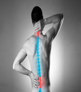 spondylosis