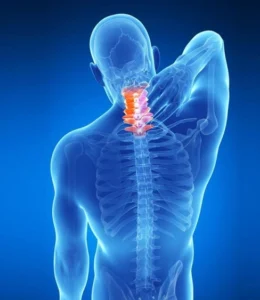 ervical Spondylosis Treatment in kphb hyderabad