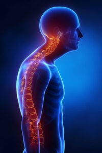 Kyphosis Treatment in kphb hyderabad