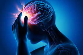 Migraine Treatment in kphb hyderabad