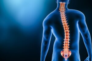 Scoliosis Treatment in KPHB Hyderabad